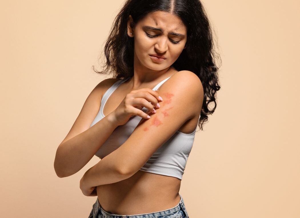 annoying allergy