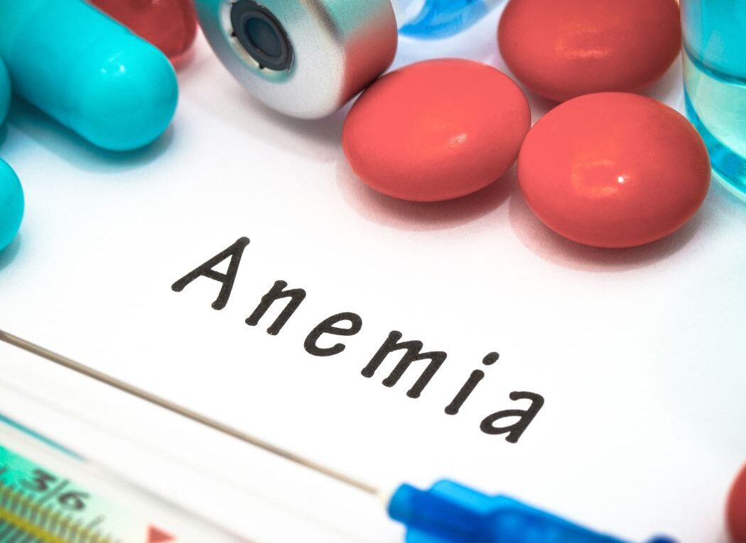 Iron-Deficiency Anemia: 5 Powerful Ways to Combat It and Stay Healthy