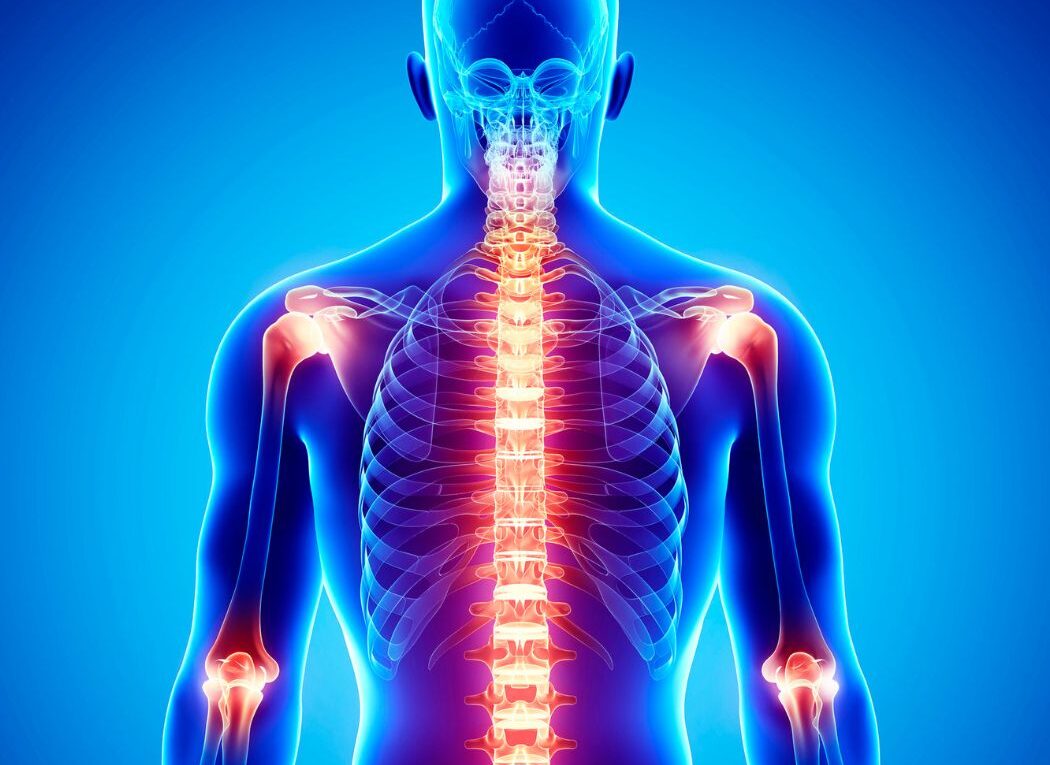 Conquer Pain: 5 Powerful Foods That End Discomfort and Boost Relief
